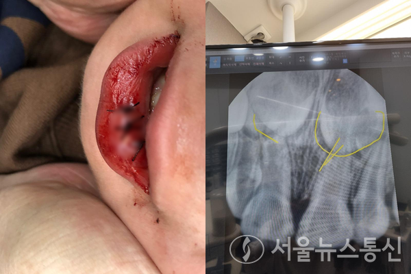 / 온라인 커뮤니티 보배드림 캡처