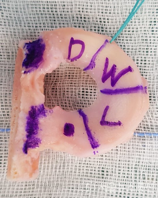 반월연골판 이식술을 위해 기증받은 반월연골판의 모습. / 사진=건국대병원 제공