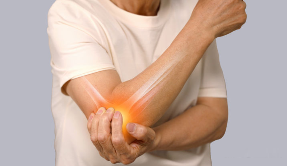 테니스엘보(외측상과염)는 팔꿈치 바깥쪽 돌출 부위의 힘줄에 염증이 생겨 통증을 유발하는 질환이다. / 사진 = 유토이미지 제공