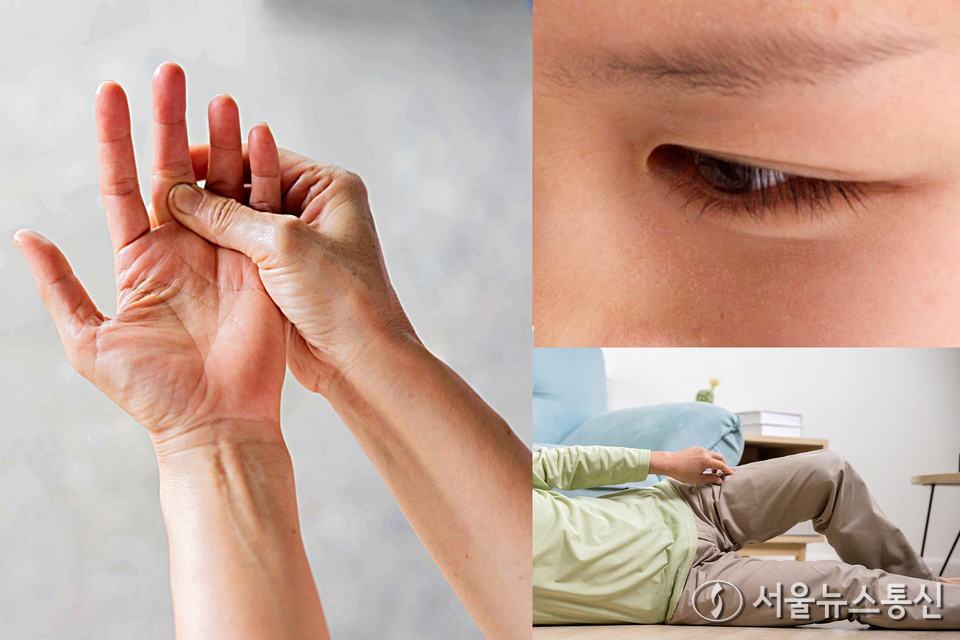 갑자기 팔이나 다리에 힘이 빠지고, 사물이 두 개로 겹쳐 보인다면 ‘다발성경화증’을 의심해야 한다는 의료계의 조언이 나왔다. (다발성경화증_.2025.10.22) / 사진 = 서울뉴스통신 DB 