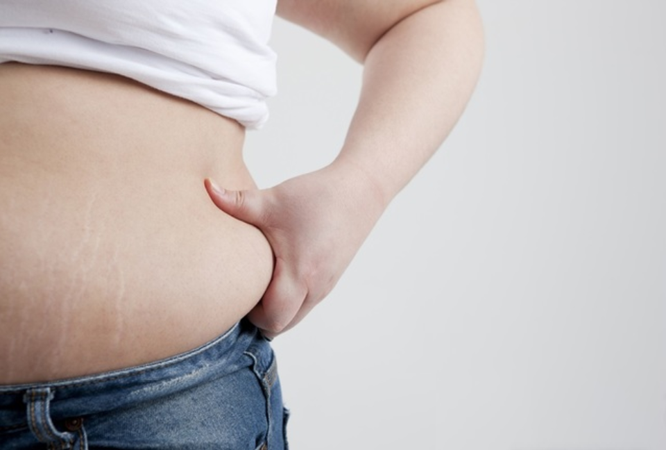 국민건강보험공단이 ‘대사증후군 건강관리 서비스’ 신규 가입 이벤트를 진행하며 건강관리와 경품 혜택을 동시에 제공한다. (복부비만) / 사진= 유디두암치과의원 제공